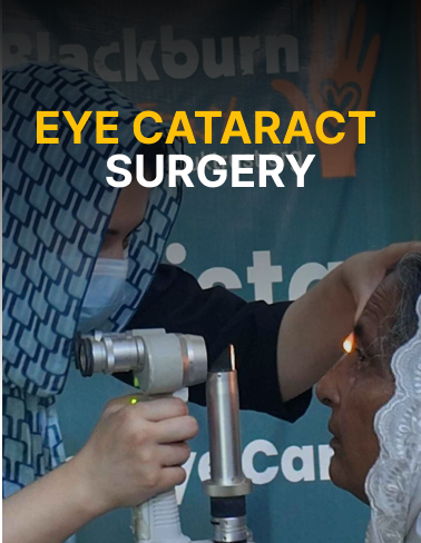 eye cataract surgery